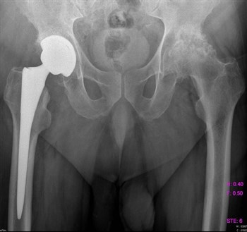 Если болит пах температуры нет спина болит