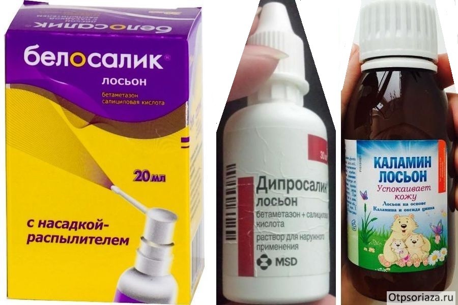 Белозалик, дипросалик, каламин от псора Лосьоны от псориаза волосистой части головы