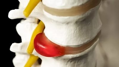 можно ли делать массаж когда болит спина в