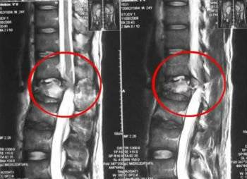 Болит позвоночник когда наклоняю голову