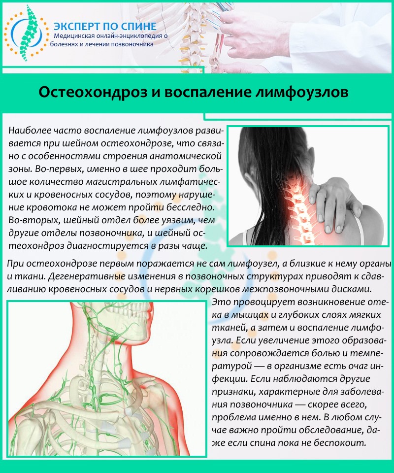 Остеохондроз и воспаление лимфоузлов