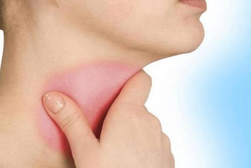 болит горло и голова жар но температуры нет что это