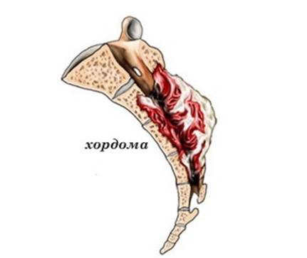 У меня болит спина и опухли ноги