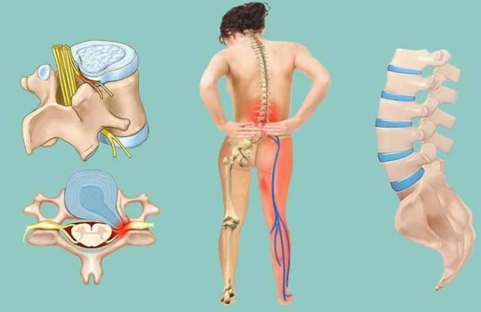 У меня болит спина и опухли ноги