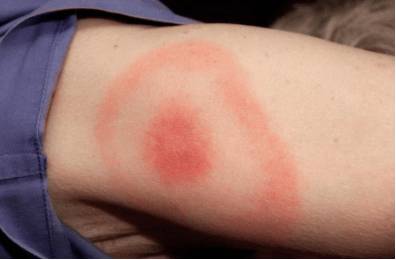 Болит голова слабость недомогание