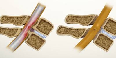 Если болит пах температуры нет спина болит