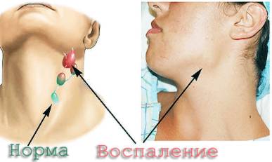 От чего болит спина и повышается температура