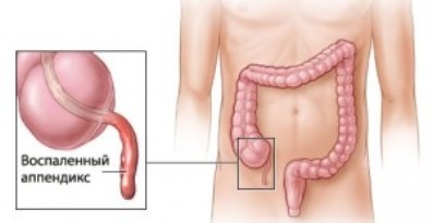 Болит желудок голова озноб