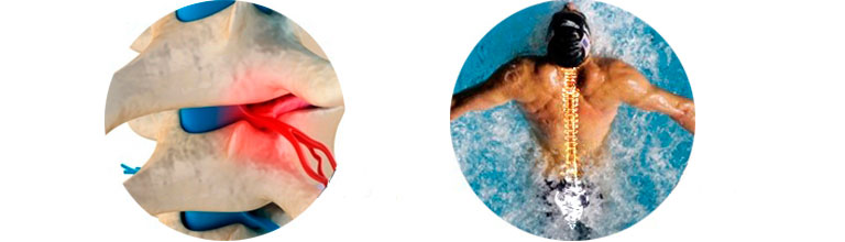 болит спина плавать в бассейне