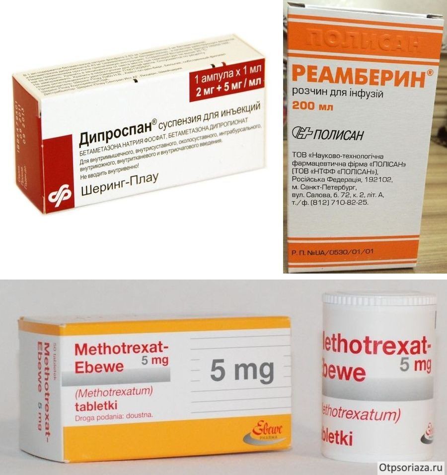 Дипроспан, реамберин и метотрексал от псориаза Медикаментозное лечение псориаза
