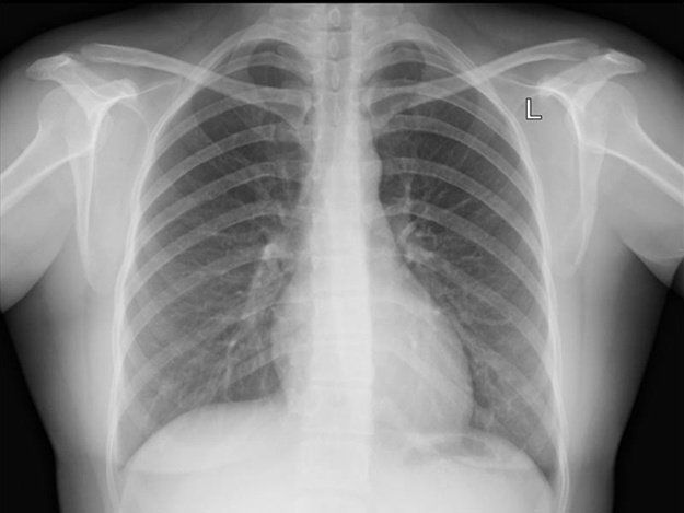 Флюорография