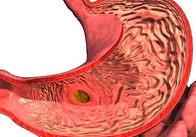 Болит желудок голова озноб
