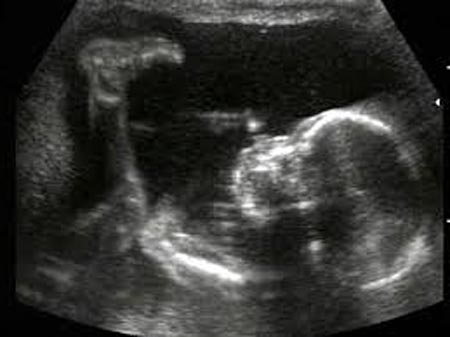 наиболее точно фото узи