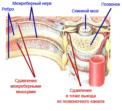 Почему болит спина в области ребер справа