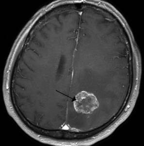 Болит голова слабость недомогание