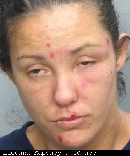 после амфетамина после амфетамина