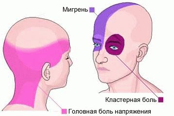 Голова болит лекарства не помогают